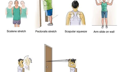 13 Best Exercise for Thoracic Outlet Syndrome - Samarpan Physio