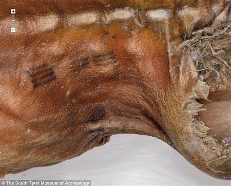 Otzi the Iceman was at increased risk of heart disease | Daily Mail Online