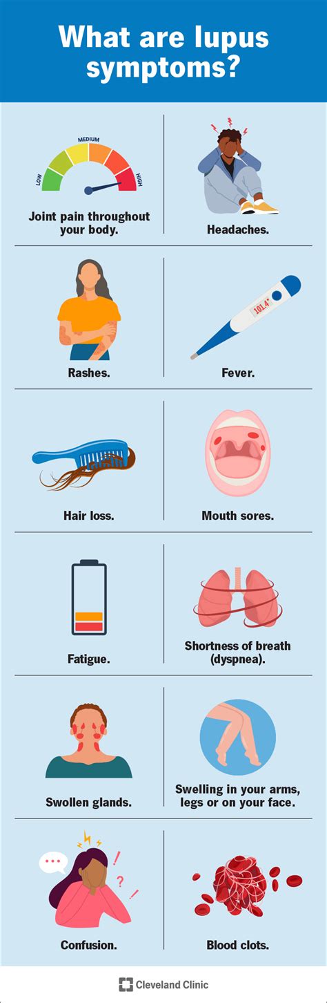 Lupus: Symptoms & Treatment