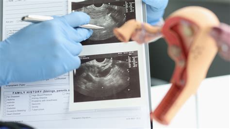 Why Ultrasound Alone Cannot Diagnose PCOS — The Clara Clinic