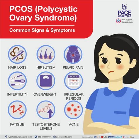 PCOS - AntimoMariluz