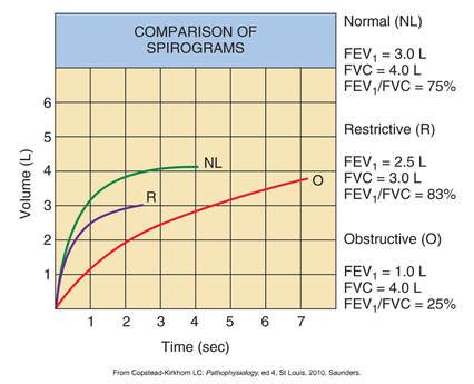 Spirometry Normal Values Chart