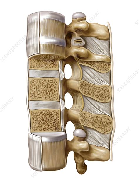 Intervertebral joints, artwork - Stock Image - C021/1192 - Science ...