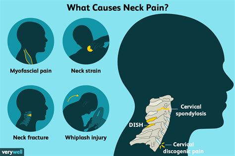 Neck Pain: Causes, Treatment, and When to See a Healthcare Provider