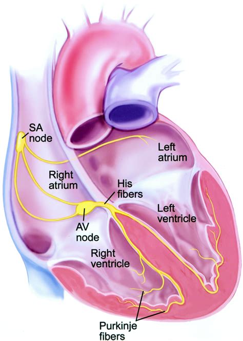 Supraventricular Tachycardia | Circulation