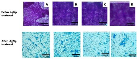 1: Shows the crystal violet assay staining without silver nanoparticles ...