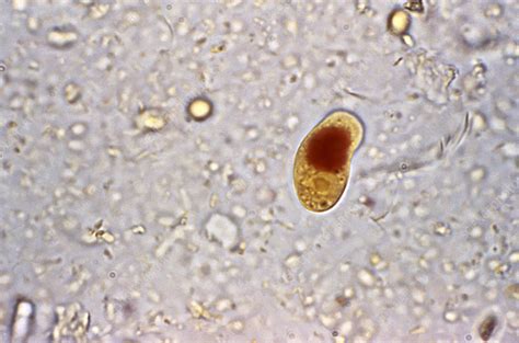 Iodamoeba buetschlii parasitic cyst - Stock Image - C026/6135 - Science ...