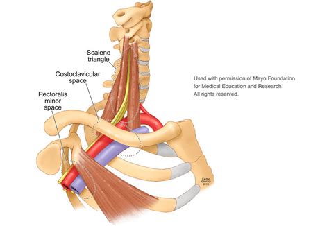 What is Thoracic Outlet Syndrome? | The Cherington Practice ...