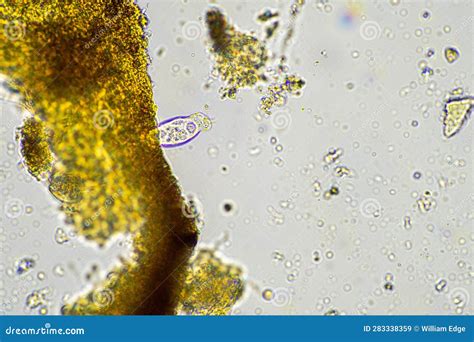 Soil Microbes Organisms in a Soil and Compost Sample, Fungus and Fungi ...