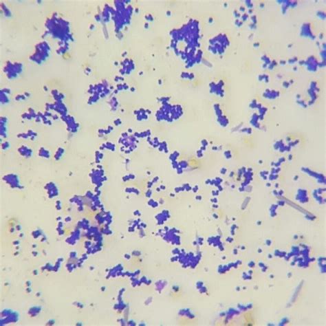 Pediococcus - Alchetron, The Free Social Encyclopedia