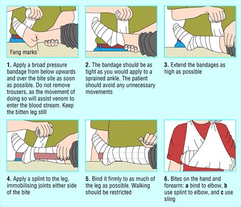 First Aid For Snake Bite