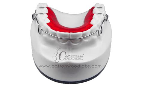 Cottonwood LabsHawley Welded Labial Bow - Cottonwood Labs