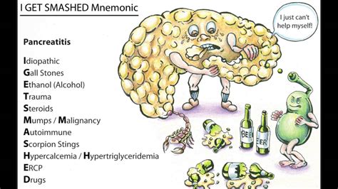 Pancreatitis Mnemonic - YouTube