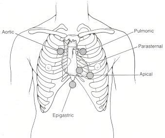 major precordial areas (will I ever feel comfortable doing these? :P ...