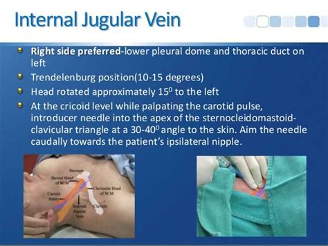 Central Venous Access | Central venous catheter, Central venous ...