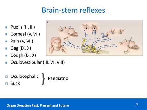 PPT - Donation after Brain-Stem Death DBD PowerPoint Presentation, free ...