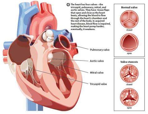 Acquired Heart Valve Disease Symptoms: Tiredness, Chest Pain, Swelling ...