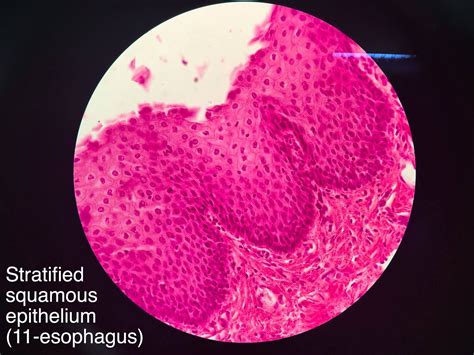 Stratified squamous epithelium (non-keratinized) | Stratified squamous ...