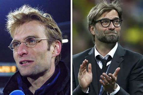 Jurgen Klopp Hair Transplant: Everything You Need To Know