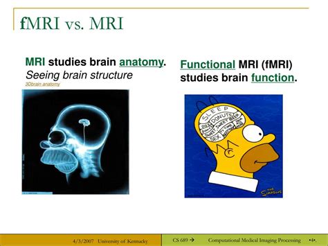 PPT - Functional MRI PowerPoint Presentation, free download - ID:5823750