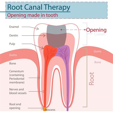 What Exactly Happens During A Root Canal? | Reno, NV