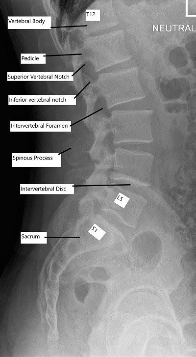 Anatomy of the Spine - Complete Orthopedics & Podiatry | Multiple NY ...