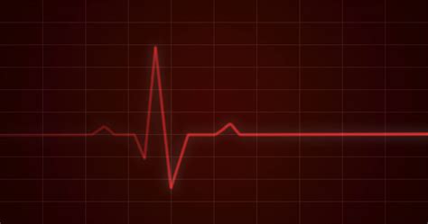 Free photo: Heartbeat Monitor Concept - Molded, Pulse, Procedure - Free ...