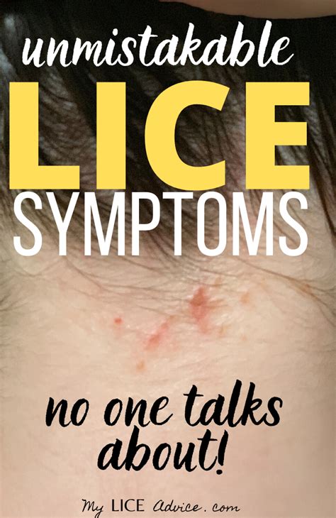 Discover 17 common head lice symptoms with pictures and find out the ...