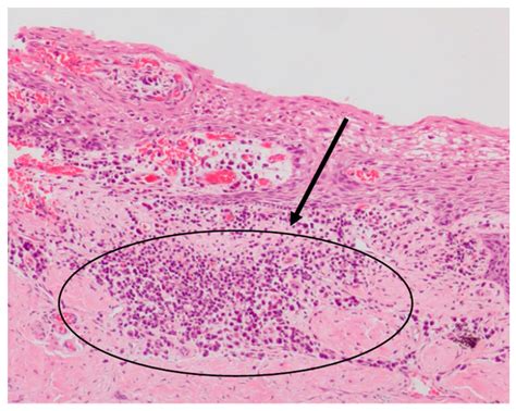 Sulcular Epithelium Histology