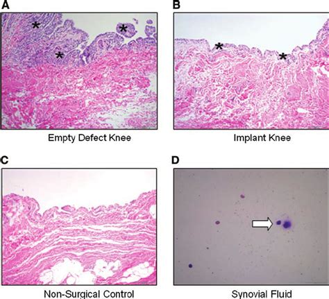 Representative histology (hematoxylin and eosin) of synovium ( A–C ...