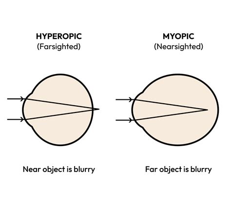 Nearsighted vs. Farsighted: What’s the Difference? | Blog | Eyebuydirect