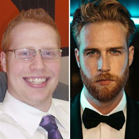 30 Men Who Are Now Rocking A Bearded Look Share How They Looked Before ...