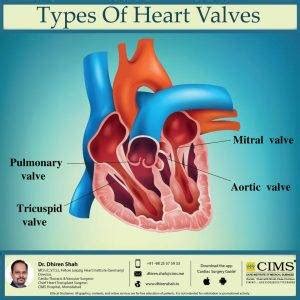 Types of heart valves. | The Best Cardiac Surgeon in Ahmedabad and Best ...