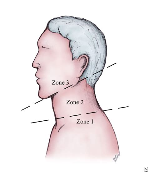 ORAL & MAXILLO-FACIAL SURGERY: Neck Trauma