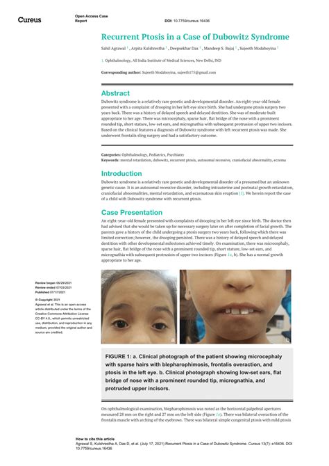 (PDF) Recurrent Ptosis in a Case of Dubowitz Syndrome