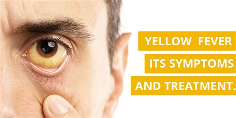 Yellow fever Symptoms And Causes - Health GadgetsNG