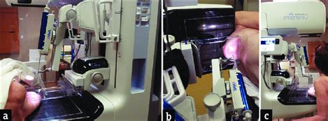 Patient positioning options for tomosynthesis-guided core biopsy of the ...