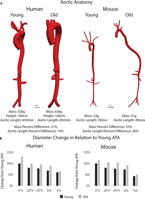 Aorta Size Chart Male Female