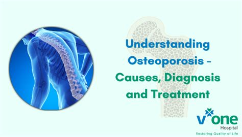 Osteoporosis Diagnosis