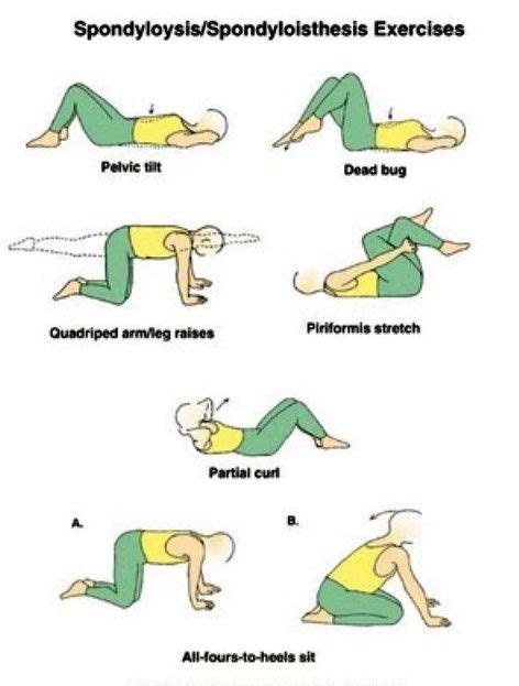 LUMBAR SPONDLYLOYSIS EXERCISES - EXCLUSIVE PHYSIOTHERAPY GUIDE FOR ...