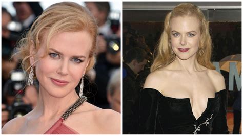 Nicole Kidman's Plastic Surgery: What Changes Did She Make? | IWMBuzz