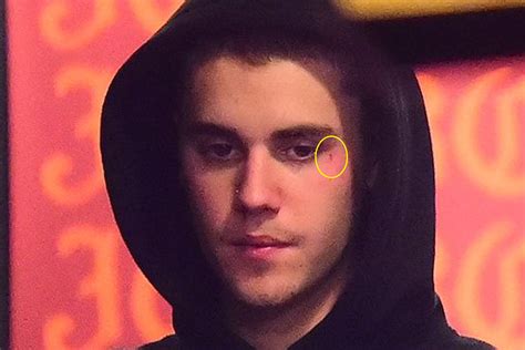 Justin Bieber Gets a Face Tattoo: Check Out His Latest Ink