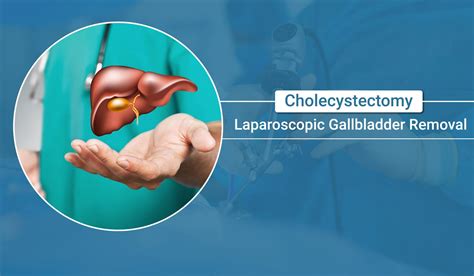 Laparoscopic Gallbladder Removal: Understanding the Procedure