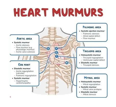 Heart Murmurs - MEDizzy