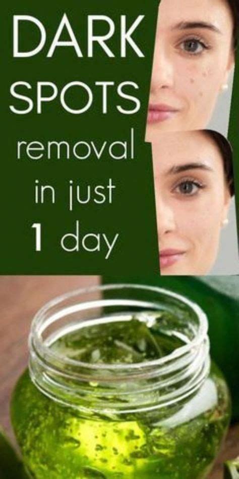 Remove Dark Spots In 1 Day With This Natural 3 Ingredient Recipe ...