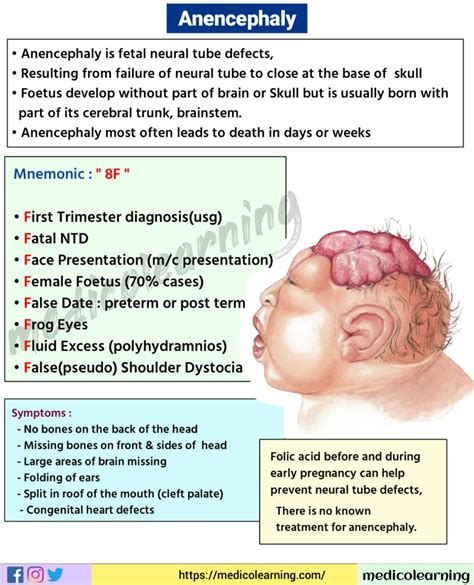 Anencephaly – MedicoLearning