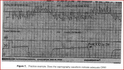 Patient Scenarios - Capnography Training