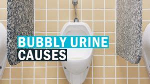 Learn Reason of having Bubbles In Urine and Is It Ok for Health?