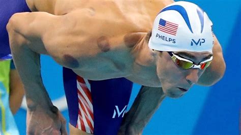 Michael Phelps brings ancient cupping to Rio Olympics | Cupping ...