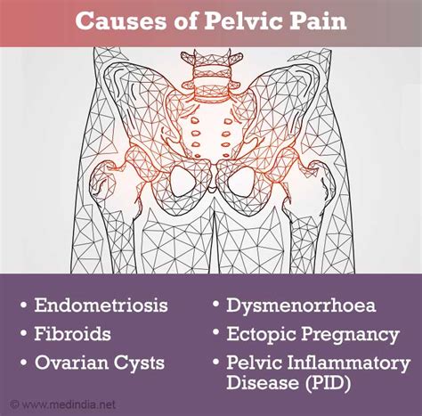 Pelvic Pain in Women - Causes - Symptoms - Diagnosis - Treatment